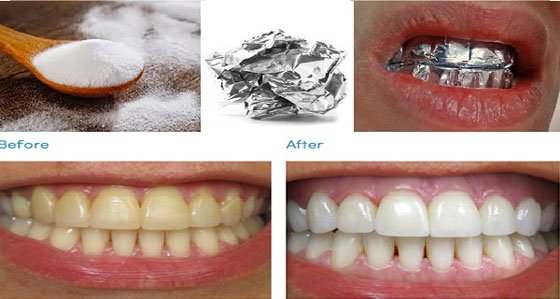 طرقٍ طبيعيةٍ لتبييض الأسنانِ الصفراءِ في البيت فى ربع ساعه بس
